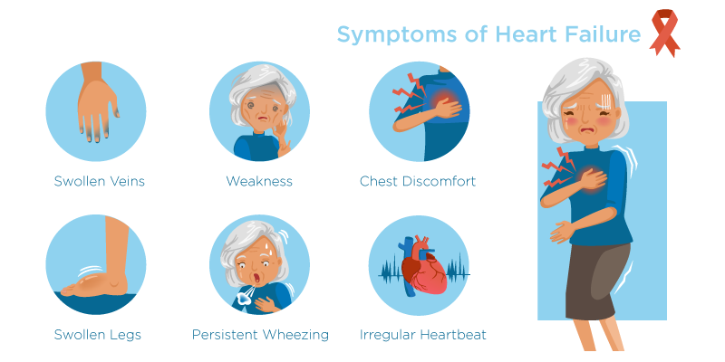 Symptoms-of-Heart-Failure