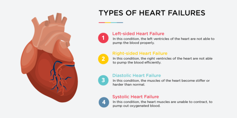 What cause heart failure
