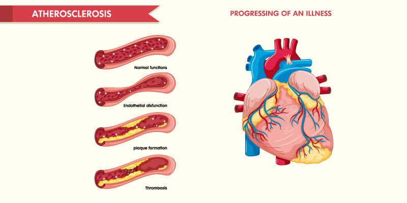 Causes-of-Structural-Heart-Disease